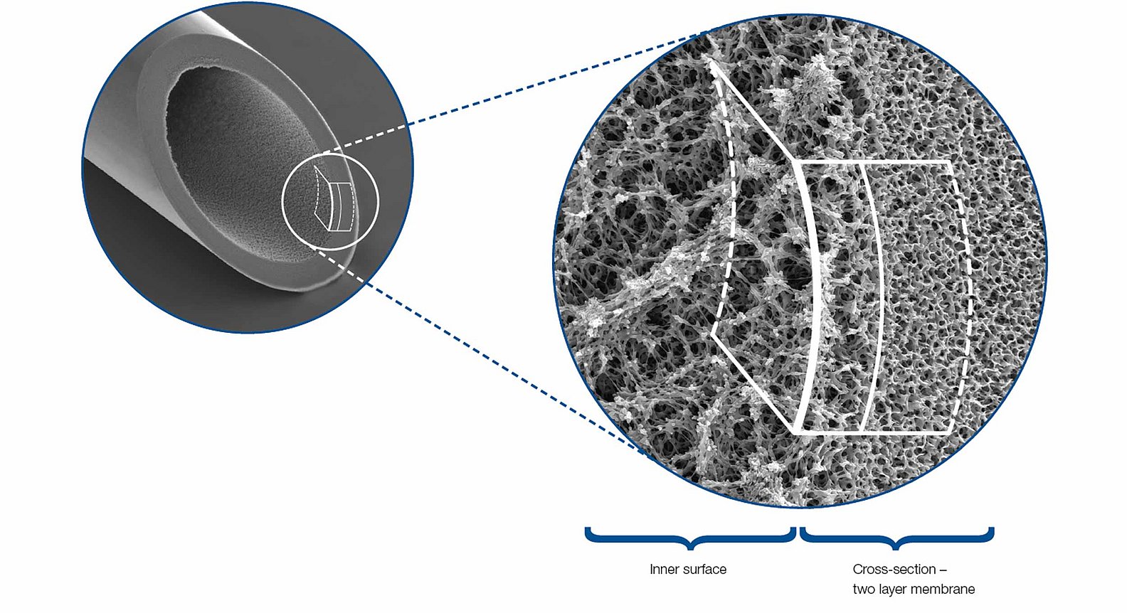 Snímek plazmafiltru z elektronového mikroskopu
