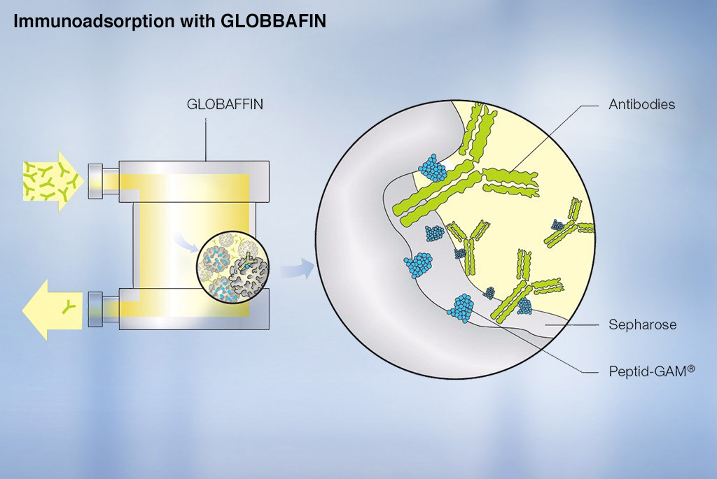 Imunoadsorpce s adsorbérem GLOBAFFIN